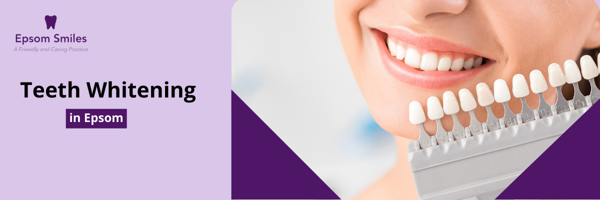 Teeth Whitening in Epsom