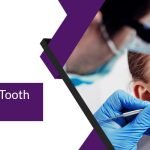 Come to Epsom Smiles for Tooth Fillings in Cheam