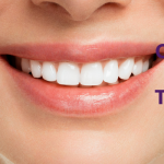 What's Causing Your Bad Breath? Top Tips From Dentists in Banstead