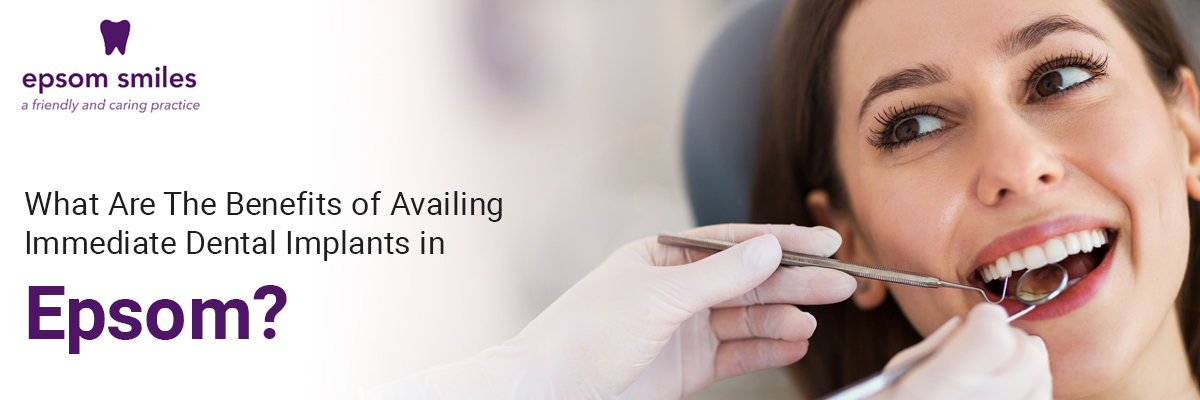 What Are The Benefits of Availing Immediate Dental Implants in Epsom?