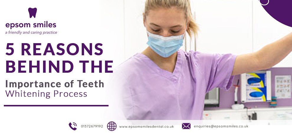 5 Reasons Behind the Importance of Teeth Whitening Process