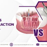 Root Canal Vs. Surgical Extraction - Best Option for Infected Tooth
